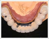 ハイテクセラミック