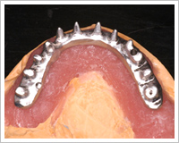 高精度チタンフレーム