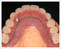 ハイテクセラミック