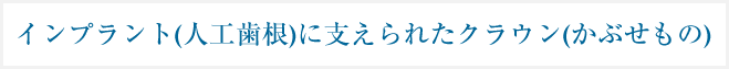 インプラント(人工歯根)に支えられたクラウン(かぶせもの)
