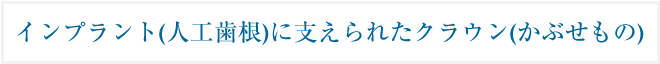 インプラント(人工歯根)に支えられたクラウン(かぶせもの)
